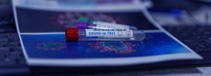Filling the Void in the Supply Chain of RT-PCR Tests for COVID-19