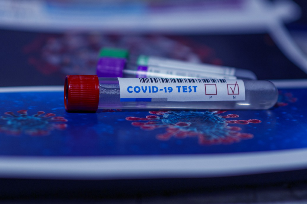 Filling the Void in the Supply Chain of RT-PCR Tests for COVID-19 new
