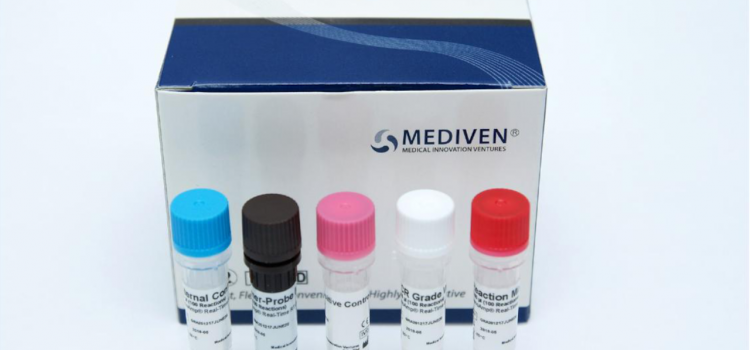COVID-19 Diagnosis: Real-Time RT-PCR Test COVID-19 Diagnosis: Real-Time RT-PCR Test